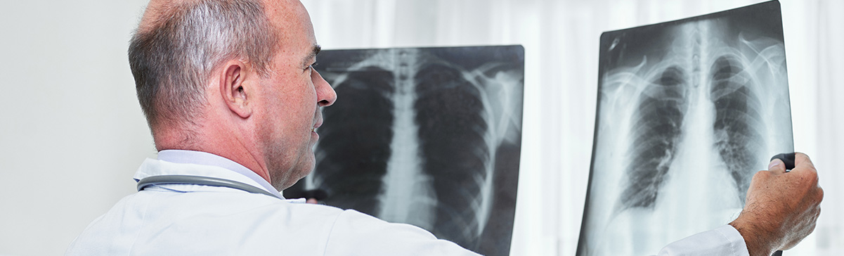 imagens_tuberculose8.jpg